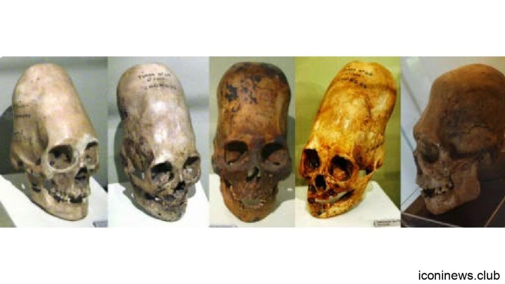 Estos 5 Extraños Cráneos Desafían La Explicación Científica