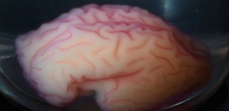 Los biólogos han impreso por primera vez tejido cerebral funcional en 3D. ¿A toda velocidad para los trasplantes de cabeza 1